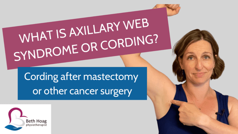 Beth Hoag, Cancer Rehabilitation Physiotherapist pointing to her armpit area where Axillary Web Syndrome or Cording can occur after a Mastectomy or Cancer Surgery.