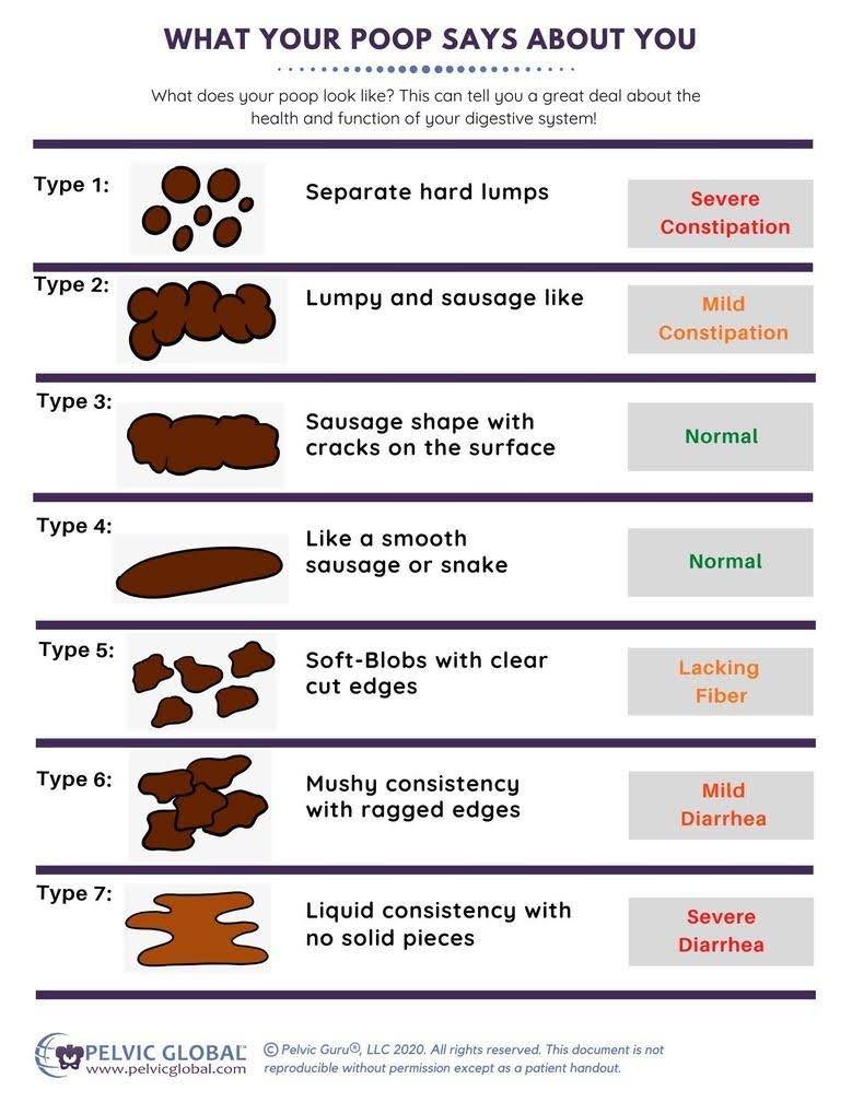 Bristol stool chart showing types of stool consistencies, a medical aid to classify stool.